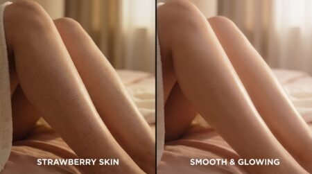 Strawberry legs cure before and after comparison